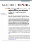 Research paper thumbnail of Visualising peripheral arterioles and venules through high-resolution and large-area photoacoustic imaging