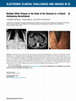 Research paper thumbnail of Multiple White Plaques in the Body of the Stomach in a Patient Undergoing Hemodialysis