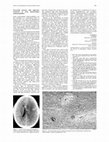 Research paper thumbnail of Successful outcome with aggressive treatment of acute haemorrhagic leukoencephalitis