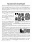 Research paper thumbnail of Harmonic phase subtraction methods are prone to B1 background components