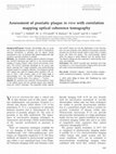 Research paper thumbnail of Assessment of psoriatic plaque in vivo with correlation mapping optical coherence tomography