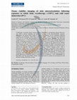 Research paper thumbnail of Tissue viability imaging of skin microcirculation following exposure to whole body cryotherapy (-110°C) and cold water immersion (8°C)