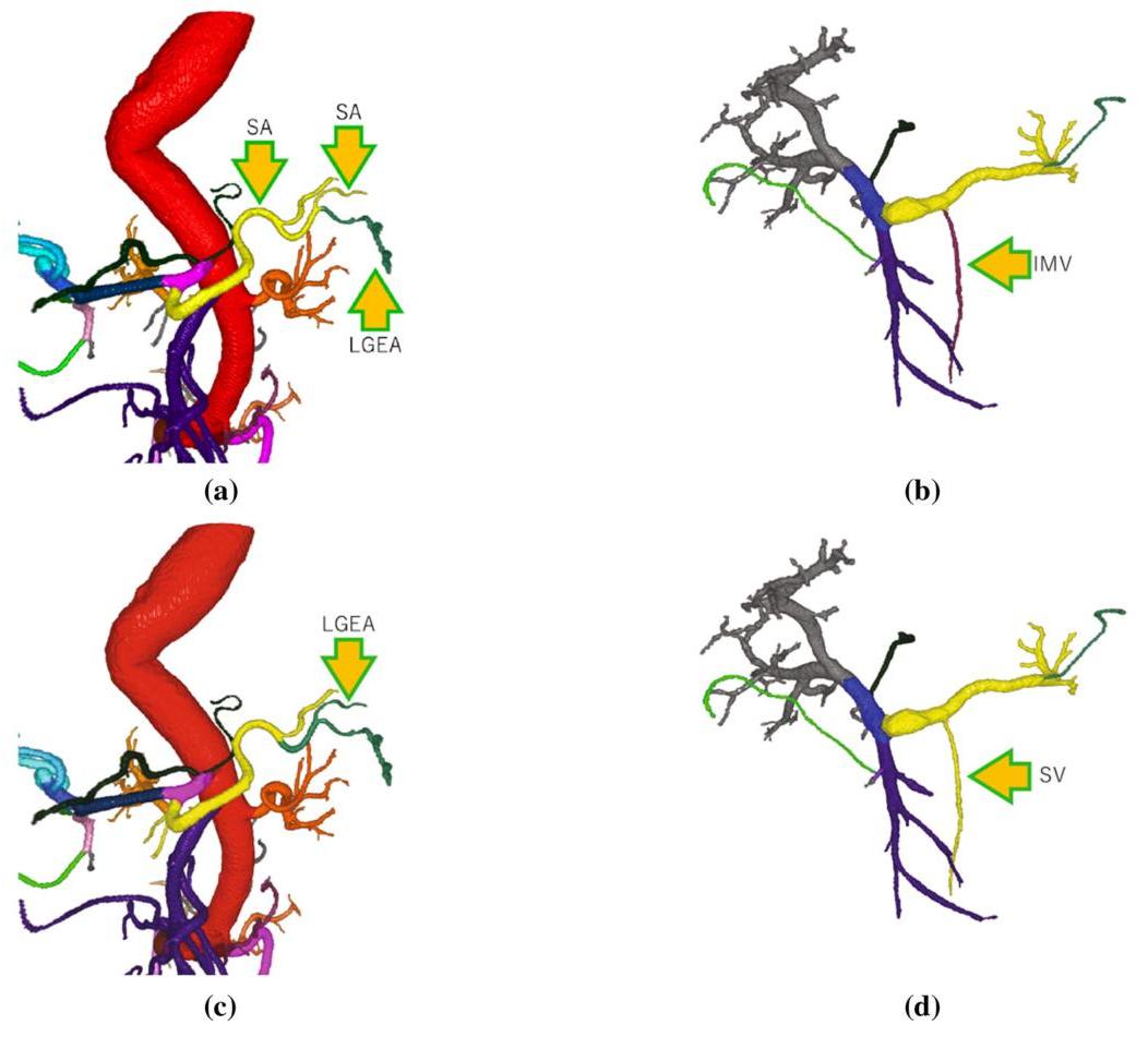 (PDF) Automatic anatomical labeling of arteries and veins using ...
