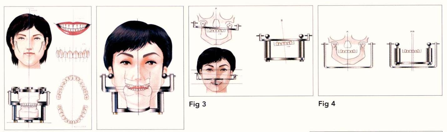 (PDF) The Application of SHILLA System to Reach the Harmony of Occlusal ...