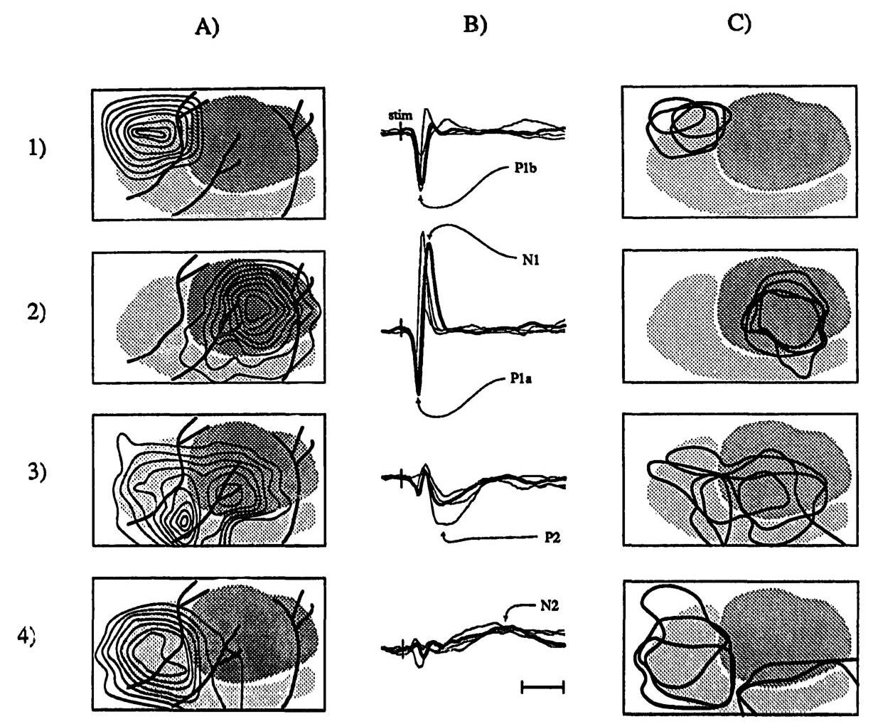 (PDF) The functional anatomy of middle latency auditory evoked potentials