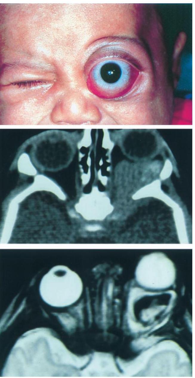 EYE CANCER | Dr. Akshay G. Nair, image size:654x1266