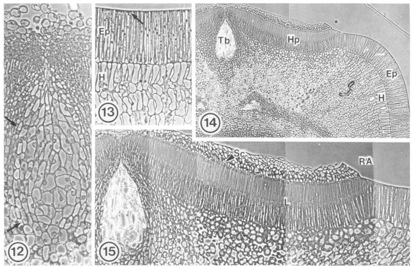 Xylem in a cross section of Cucurbita stem - prepared slide 100x objective  - UWDC - UW-Madison Libraries, image size:1354x878