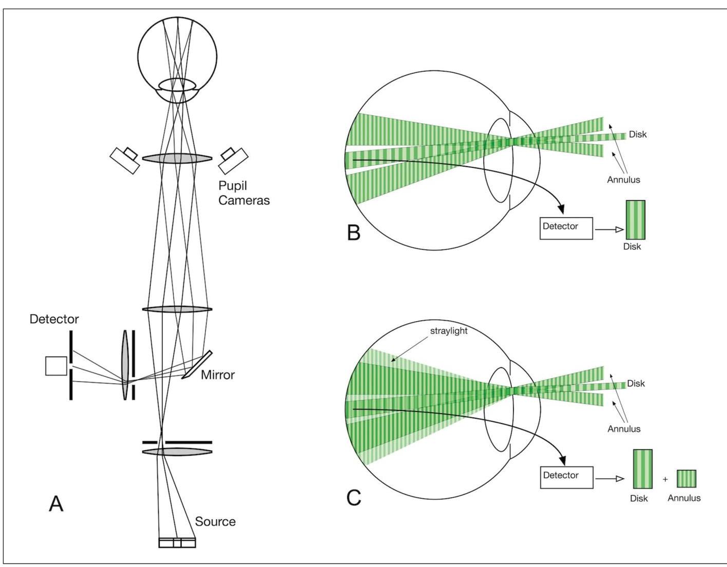 (PDF) Optical Measurement of Straylight in Eyes With Cataract