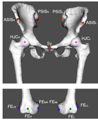 (PDF) MyHip: supporting planning and surgical guidance for a better ...