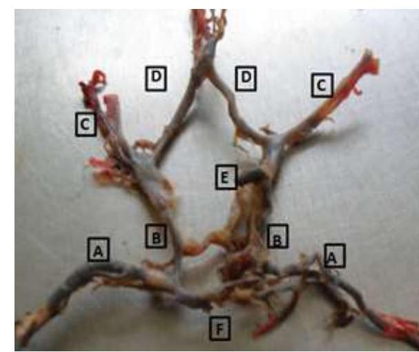 (PDF) Variations in the brain circulation – the circle of Willis